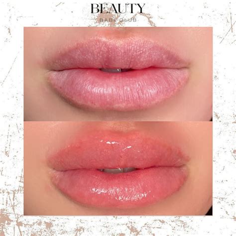 dark lip color correction treatment  lip blushing