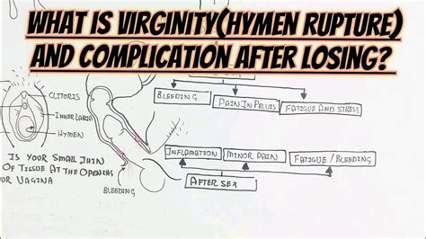 What Is Virginity Rupture Hymen And Complication Sign Symptoms After