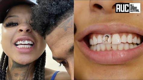 Blueface Girlfriend Gets His Face On Her Permanent Tooth Youtube