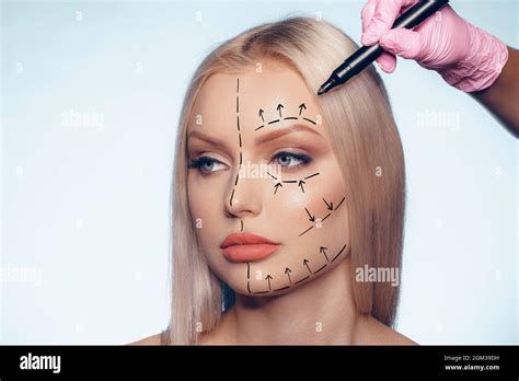 Beautiful Blonde Woman With Markings For Plastic Surgery On Her Face