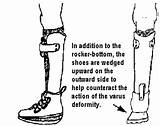 Brace Bottom Shoe sketch template