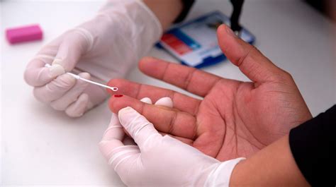 I Treated Hiv Aids Were Still Making The Same Mistake Now With Stds