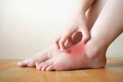 home remedies  leg swelling