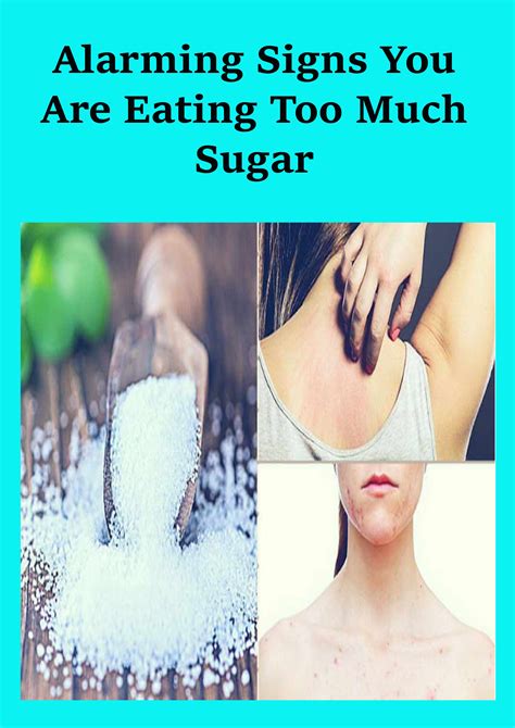 Alarming Signs You Are Eating Too Much Sugar In 2020 Skin Care