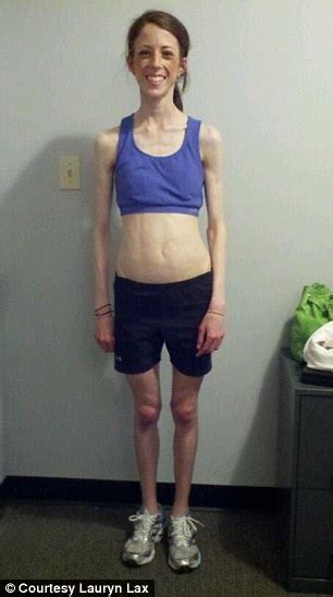 Former Anorexic Woman Lauren Lax Alive Because Of Strangers