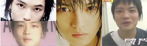 Kim Jaejoong Plastic Surgery Before And After Plastic