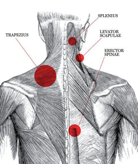 images  neck pain  pinterest muscle strain sleep
