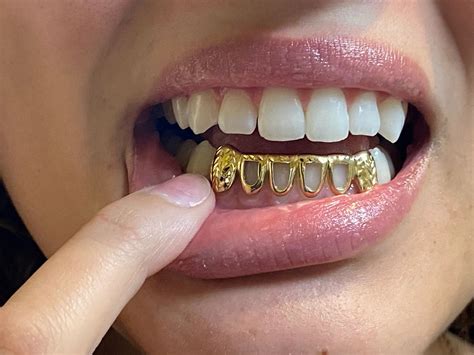 kt gold teeth
