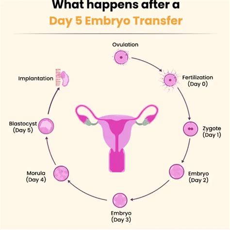 day  day   embryo transfer nua fertility