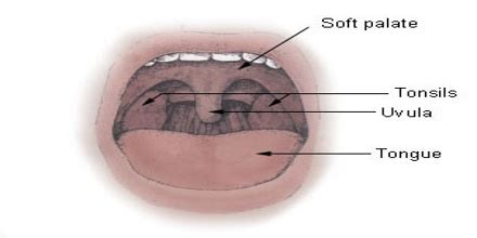 soft palate assignment point