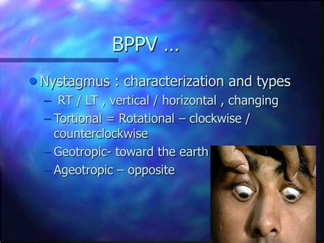 Ppt Benign Paroxysmal Positional Vertigo Powerpoint Presentation