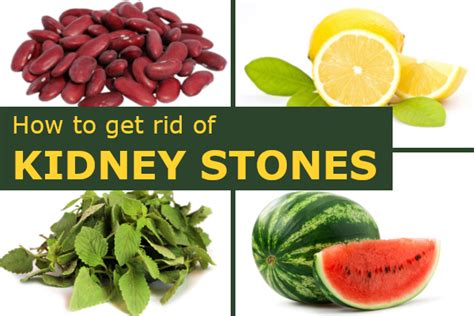 rid  kidney stones today