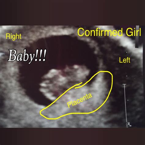 confirmed ultrasound scans  collection  boy  girl scans