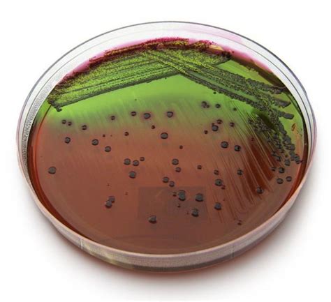 Emb Agar Composition Uses And Colony Characteristics