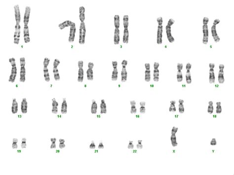 Gallery X And Y Chromosomes Chart