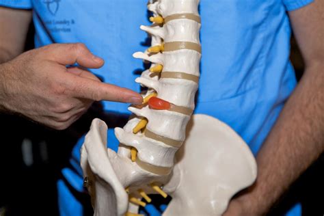 health benefits  spinal decompession  star chiropractic