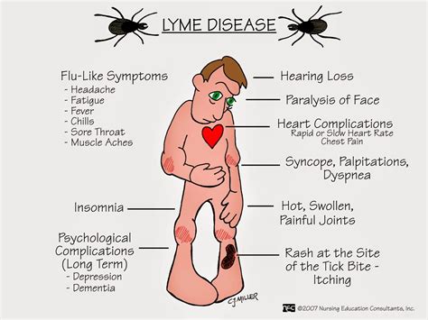 Lyme Disease Contagious Health And Disease