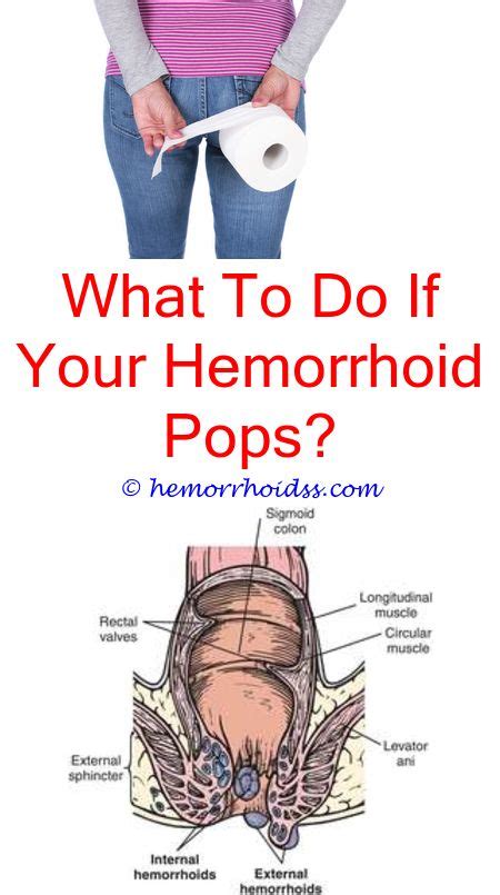 pin on hemorrhoids cure