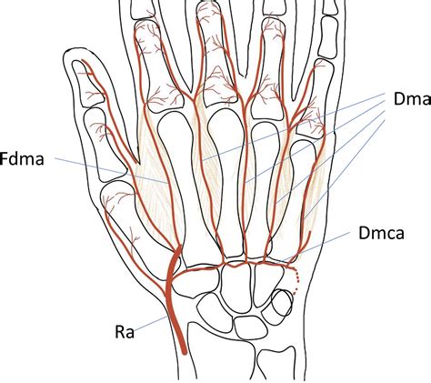 vascular anatomy   hand  relation  flaps hand clinics