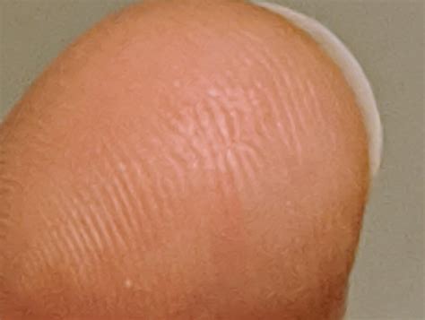 scar   fingertip  brokealtered  fingerprint rmildlyinteresting