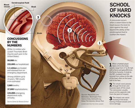 kids  concussions  effects  head injuries  young athletes njcom