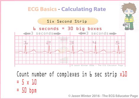 calculate heart rate  ecg strip haiper
