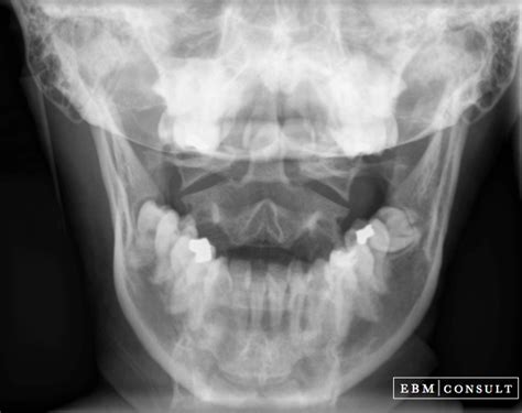 xray picture of cock in mouth sexy dance