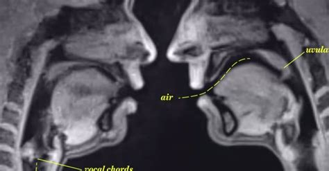 best images about mri on pinterest fields brain anatomy and hot sex