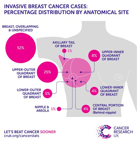 breast cancer definition sign and indication of breast cancer