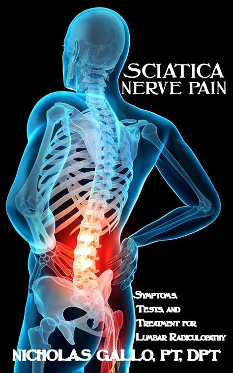 sciatic nerve pain solutions nerve zone