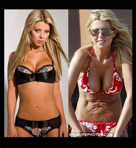 plastic surgery pictures that will scare you wtf gallery ebaum s world
