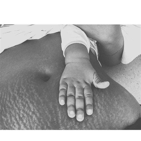 Loveyourlines Encourages Women To Embrace Their Stretch Marks
