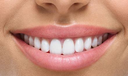zoom teeth whitening birmingham  saints dental clinic groupon