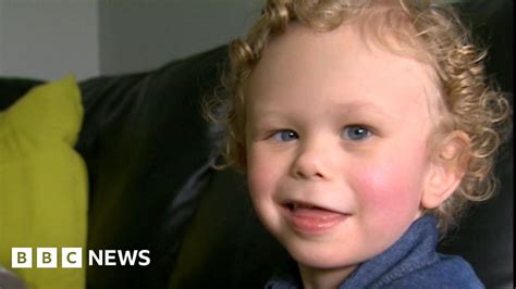 Williams Syndrome Rare Genetic Condition Needs Support Bbc News