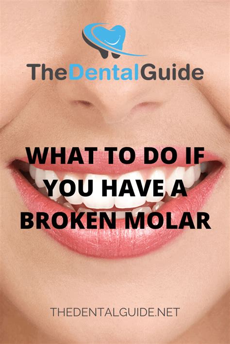 broken molar  dental guide