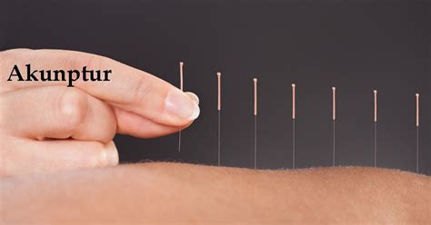 Akupuntur Apakah Akupuntur Dan Bagaimana Ia Dilakukan The Diagnosa
