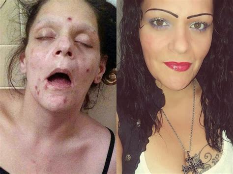 a mother shared photos showing her recovery from drug addiction