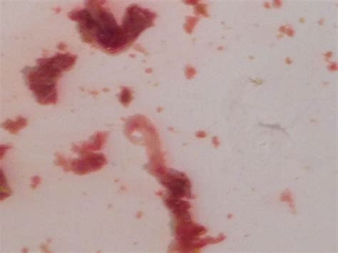 any idea what these are please help identify at parasites support forum alt med topic 2254720