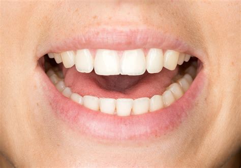 warum heilen wunden im mund  schnell wissenschaftde