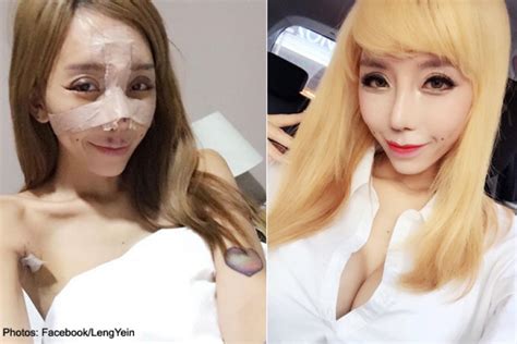 leng yein before surgery video woman finally removes makeup after 2