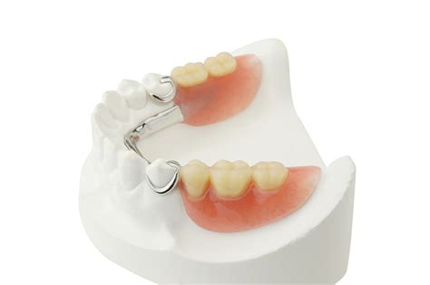 partial dentures dr james voyles family dental