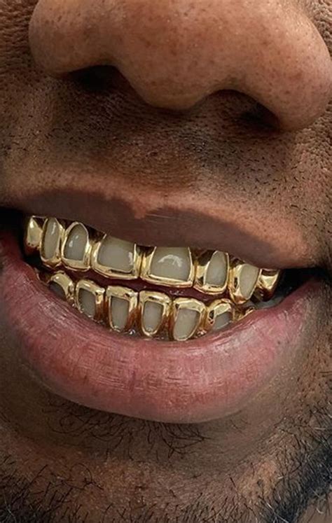 solid gold  top  bottom gold teeth master
