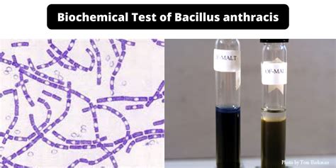biochemical test  bacillus anthracis