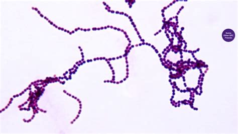 Gram Positive Cocci In Pairs And Clusters Cloudshareinfo