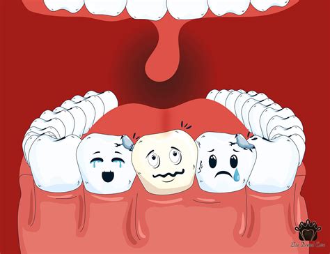 oral hygiene   importance elite dental care tracy