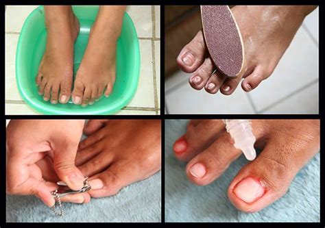 care   feet  toenails toe nails clean toenails toe nail