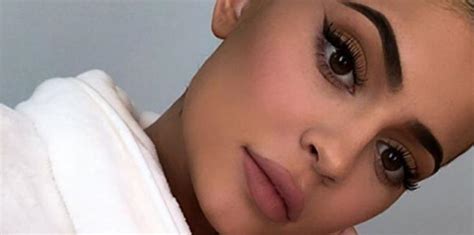 Pics Kylie Jenner Getting Lip Fillers Again After Having Them Removed