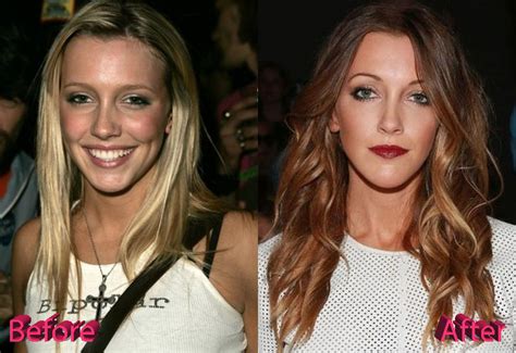 katie cassidy plastic surgery not the best of ideas