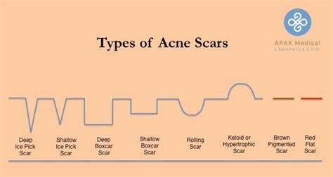 Acne Scars Types And Subtypes Apax Medical And Aesthetics Clinic