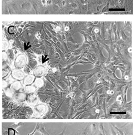 phase contrast imaging  lx  cells lx  cells grown  hs   scientific diagram